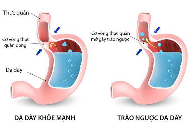 4. Phương Pháp Chẩn Đoán