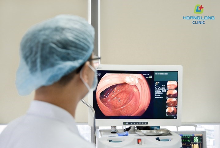 Endoscopy is one of the most effective methods to accurately diagnose different digestive diseases in the colon. 