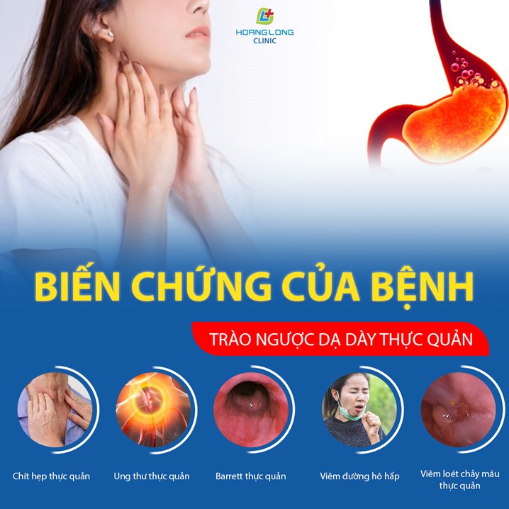 Biến chứng của bệnh trào ngược dạ dày thực quản