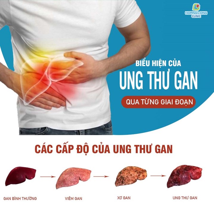 Phòng Ngừa Ung Thư Gan