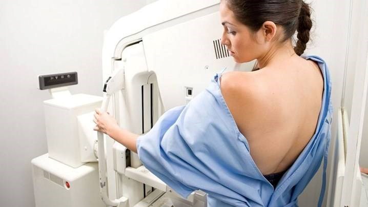 What is mammography?