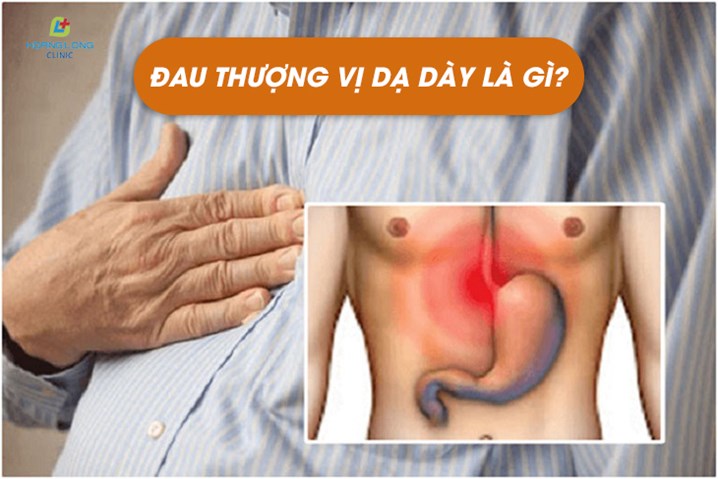 Đau dạ dày vùng thượng vị: Nguyên nhân, triệu chứng và cách điều trị hiệu quả