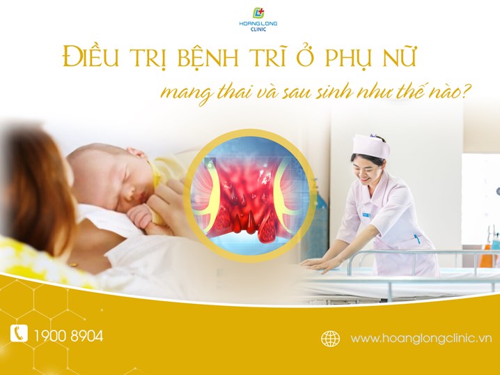 Điều trị bệnh trĩ ở phụ nữ mang thai và sau sinh như thế nào?