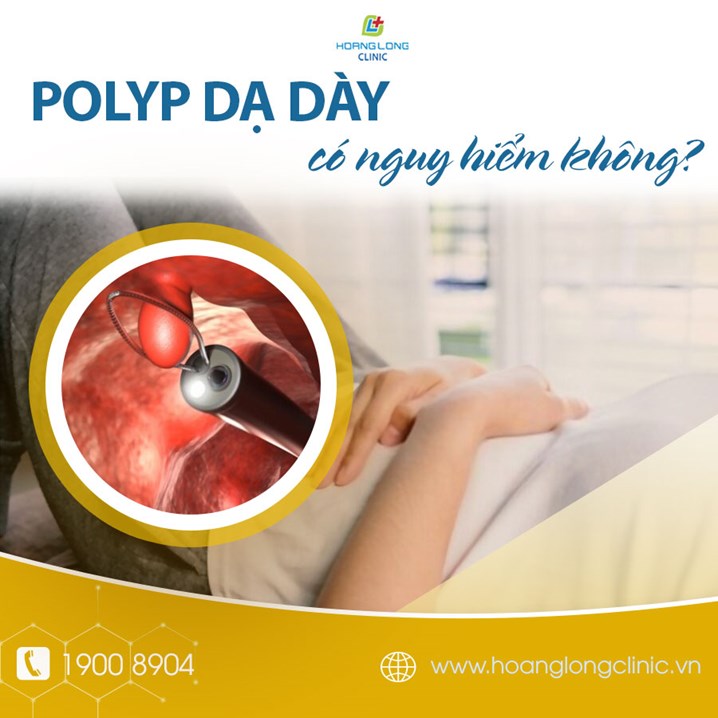 Polyp dạ dày có nguy hiểm không?