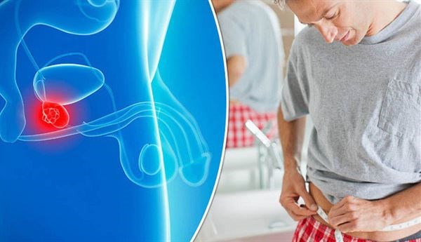 Ung thư tuyến tiền liệt gây nên nhiều rắc rối cho người mắc