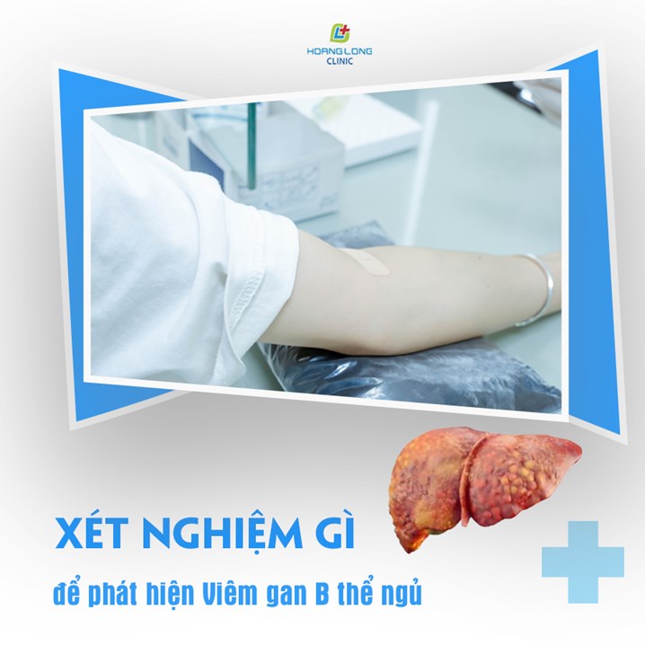 Xét nghiệm gì để phát hiện viêm gan B thể ngủ