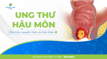 UNG THƯ HẬU MÔN: DẤU HIỆU NGUYÊN NHÂN VÀ CHẨN ĐOÁN