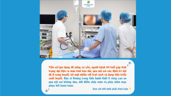 Thắt trĩ bằng vòng cao su qua nội soi ống mềm: Dứt điểm trĩ nội không cần phẫu thuật