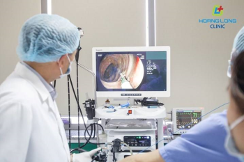 Endoscopic ultrasound – an advanced technique for diagnosing gastrointestinal tumors