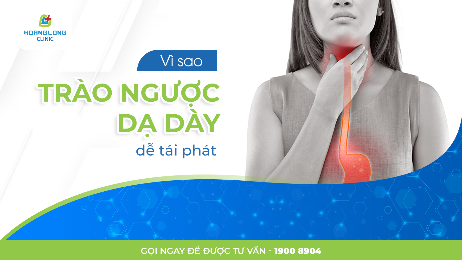 Vì sao trào ngược dạ dày dễ tái phát?
