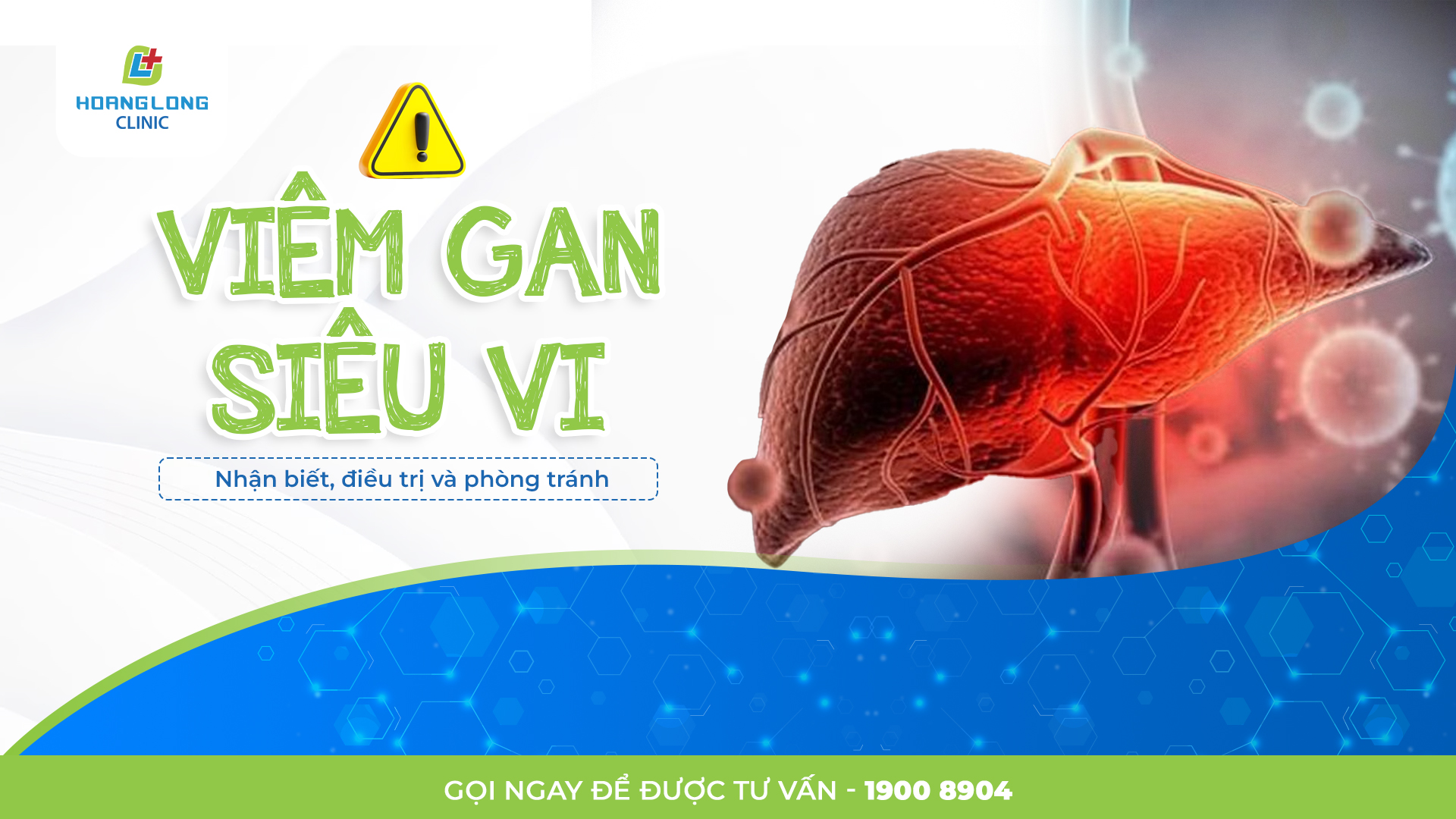 VIÊM GAN SIÊU VI LÀ GÌ? NHẬN BIẾT, ĐIỀU TRỊ VÀ PHÒNG TRÁNH