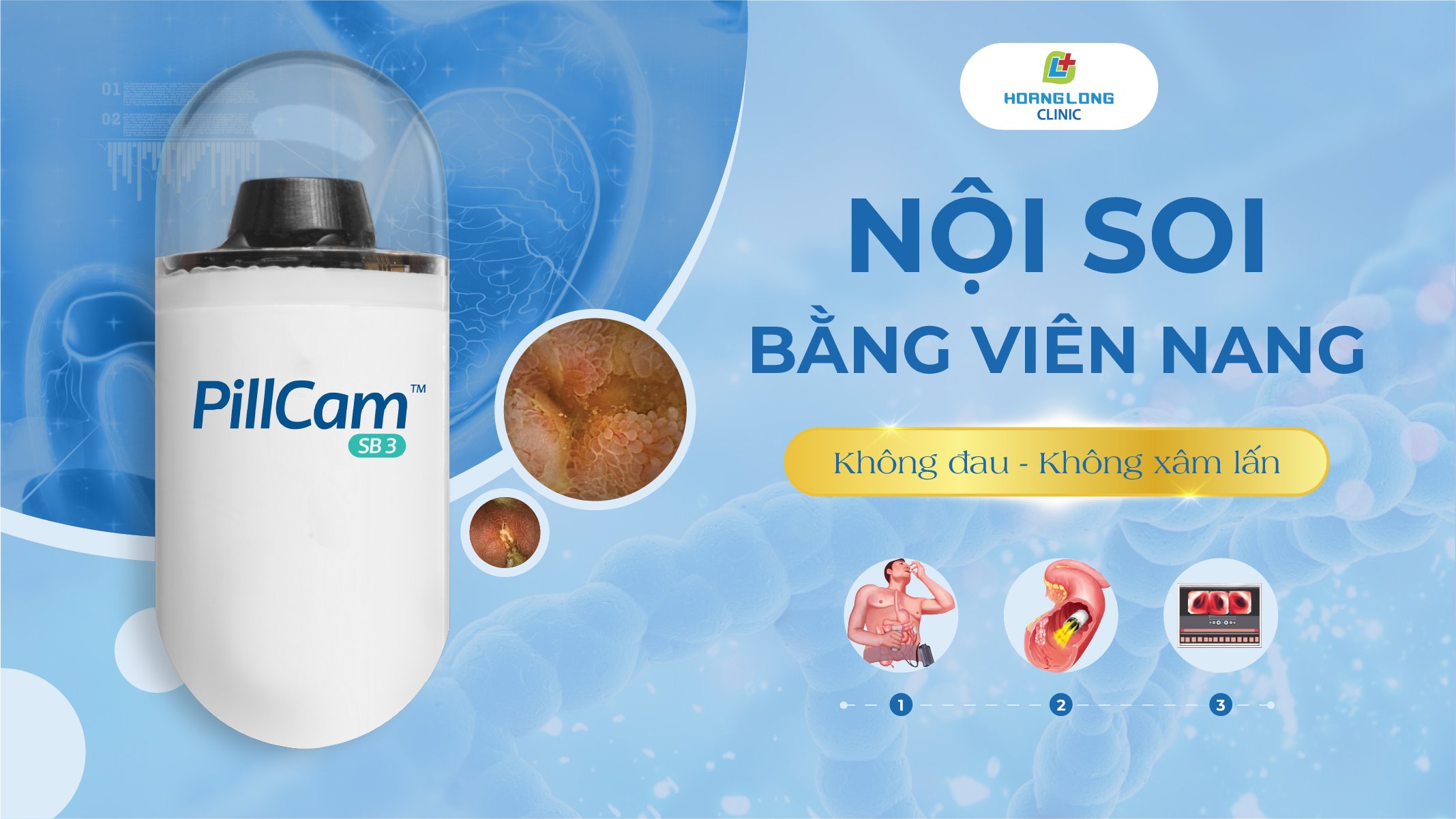 NỘI SOI VIÊN NANG KHÔNG ĐAU - KHÔNG XÂM LẤN