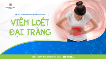 Vai trò của nội soi trong chẩn đoán viêm loét đại tràng