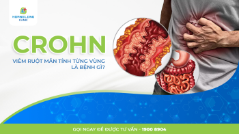 CROHN - VIÊM RUỘT MÃN TÍNH TỪNG VÙNG LÀ BỆNH GÌ?