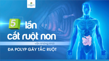 5 LẦN CẮT RUỘT NON VẪN KHÔNG KHỎI ĐA POLYP GÂY TẮC RUỘT